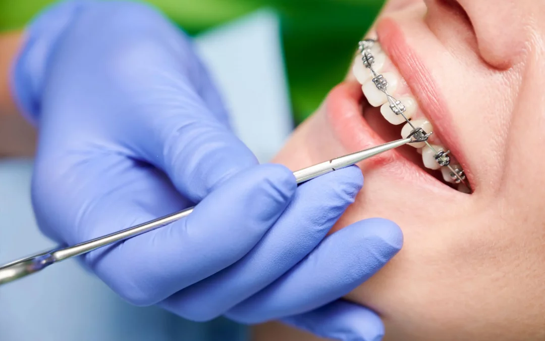 What Do Orthodontists Do?
