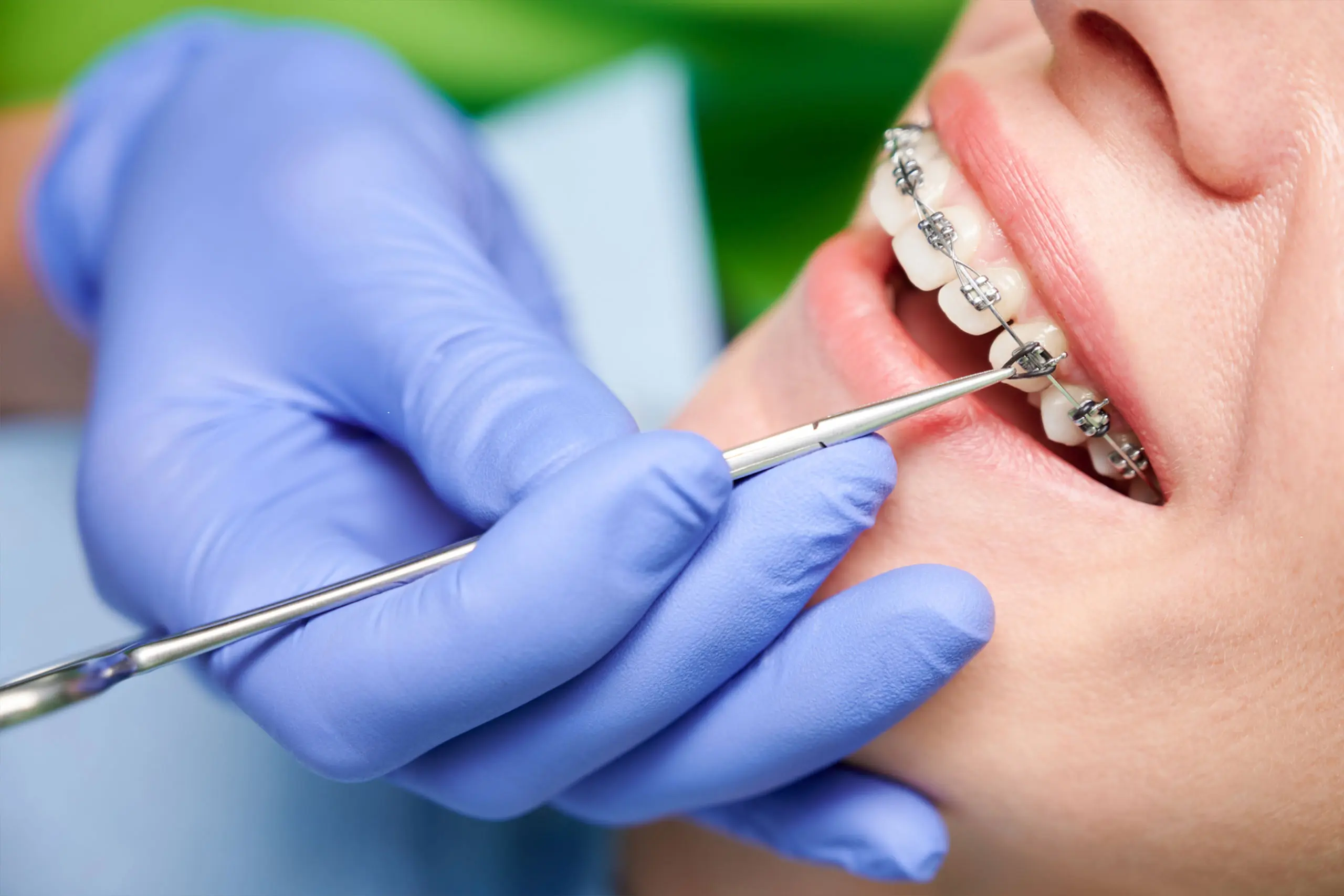teeth