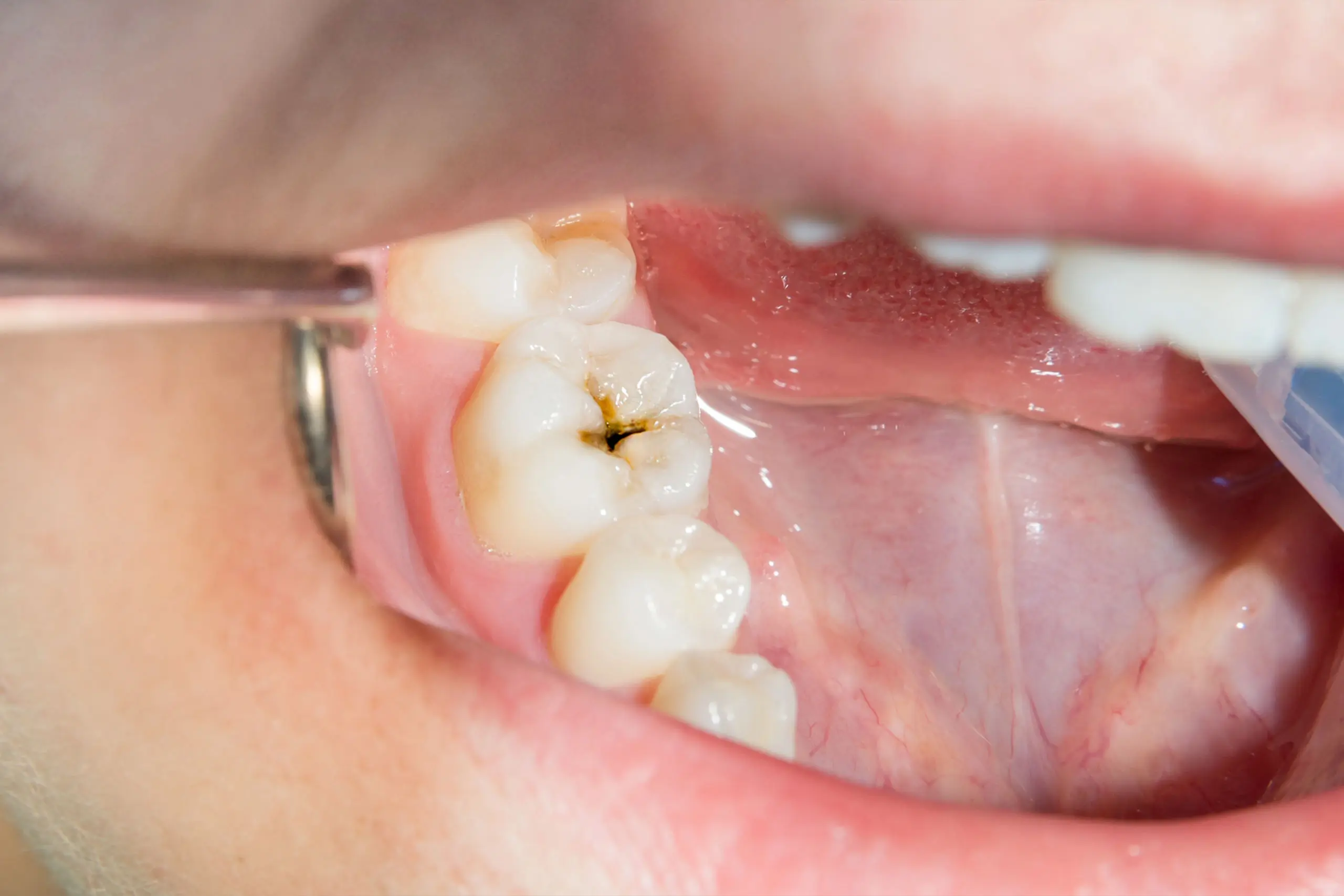 teeth teeth
